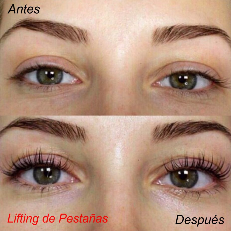 Lifting-Pestañas-2